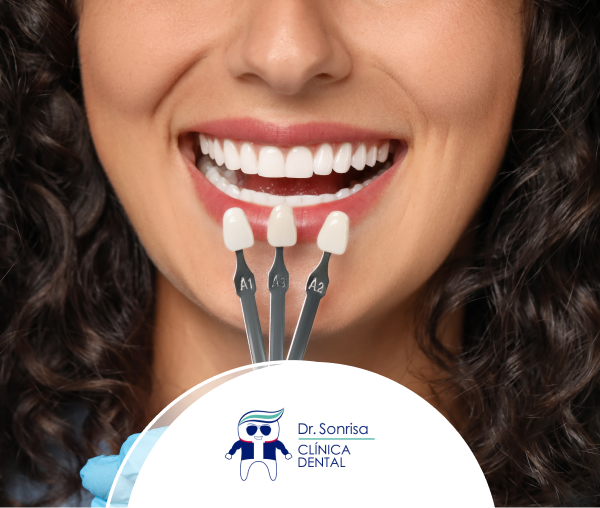 Doctor Sonrisa 20 des Blanqueamiento Dental_W